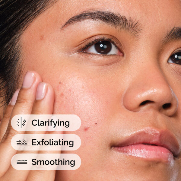 The Ordinary Salicylic Acid 2% Exfoliating Acne Solution 30ml - Image 3